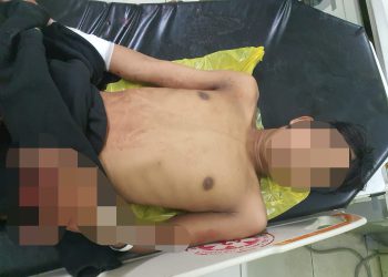 Diserang Pria Tak Dikenal, Jari Tangan Yoga Luka Parah