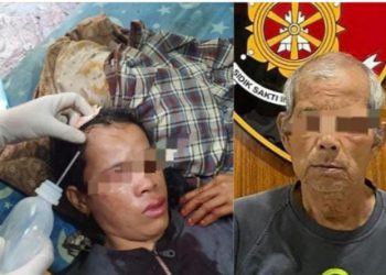 Dipukul Suami Pakai Panci, Kepala Istri dapat Tiga Jahitan