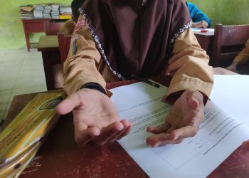 Penyakit Scabies Serang Empat Murid SDN Kelayan Selatan 1 